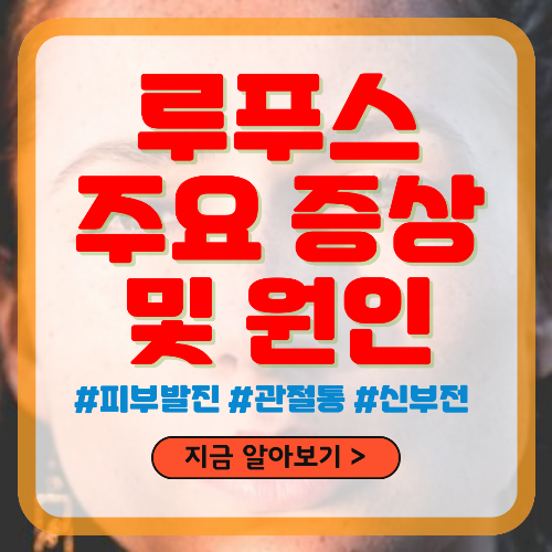 루푸스 주요 증상 및 원인