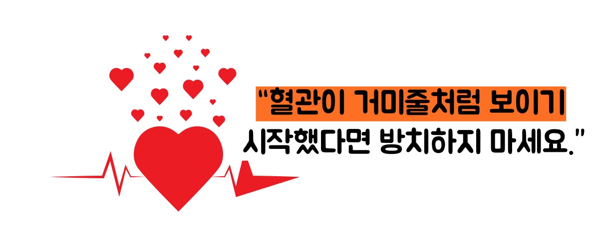 하지 정맥류 증상