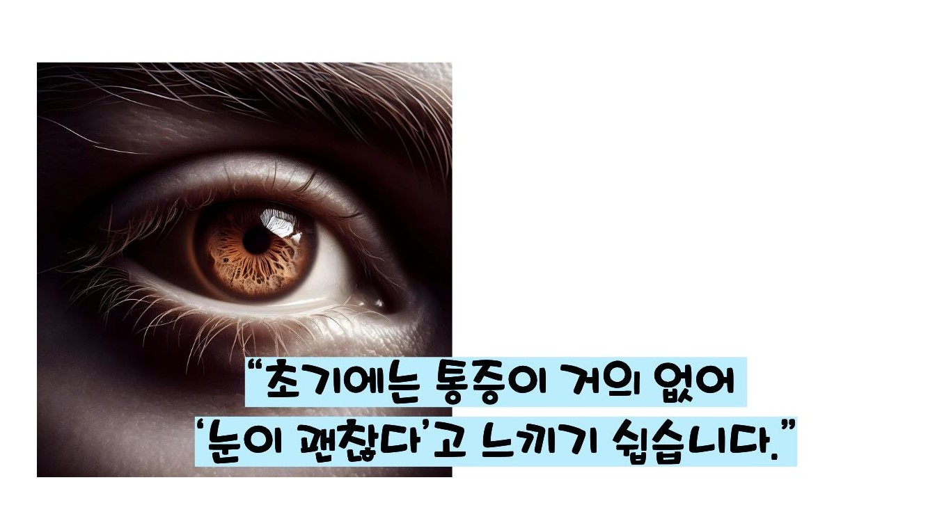 녹내장 초기증상