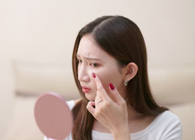 여드름