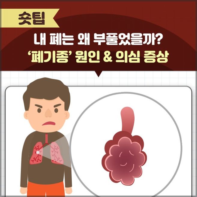 호흡기 질환: 폐기종- 원인, 증상, 치료방법, 진해단계, 진행속도 조절방법.