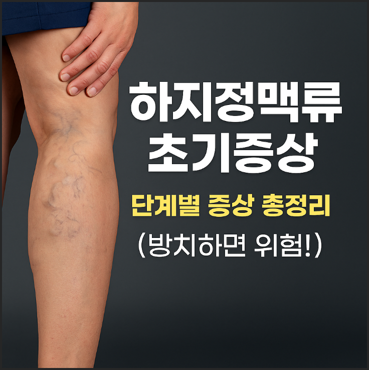 하지정맥류 초기증상과 단계별 증상 총정리