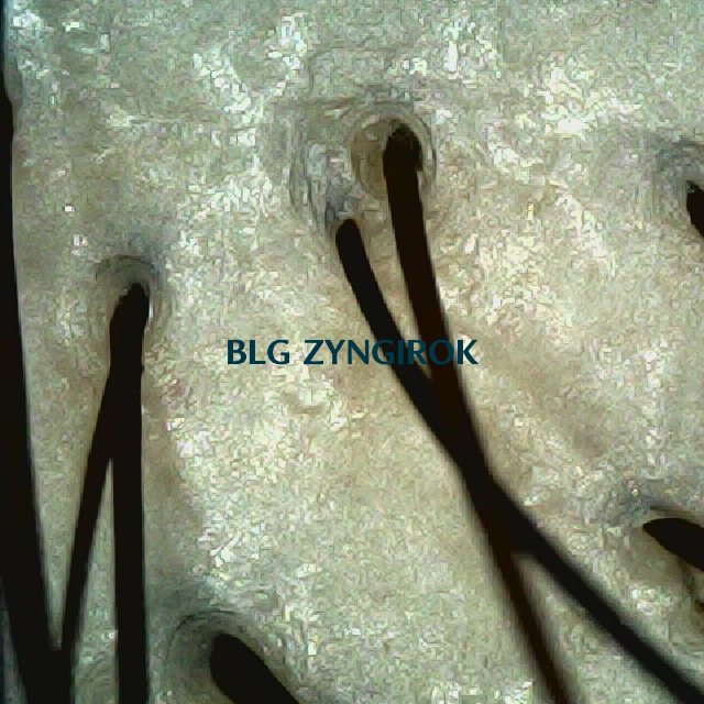 피나모아 복용 6주차 두피사진 - 정수리 모습이다.