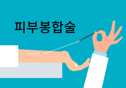 피부봉합술