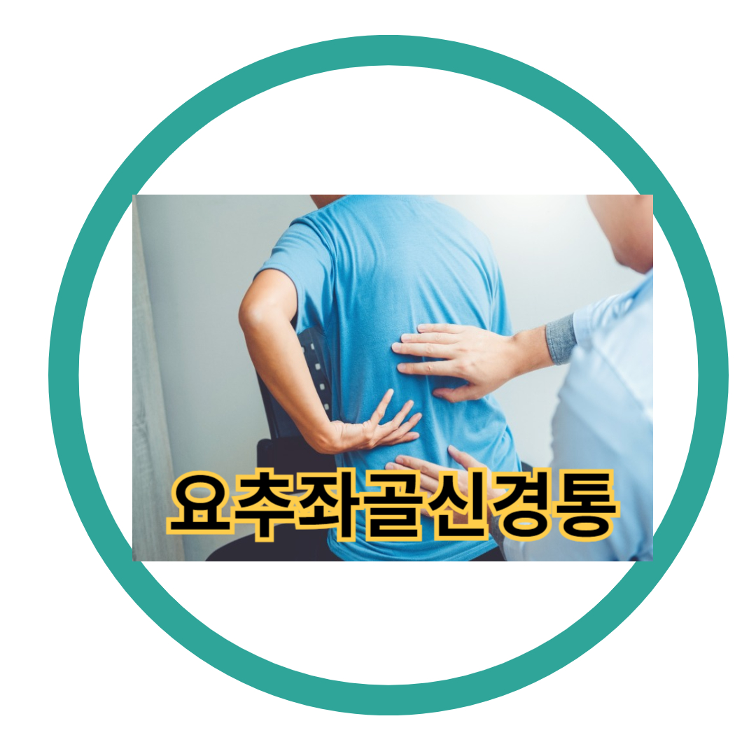 요추좌골신경통