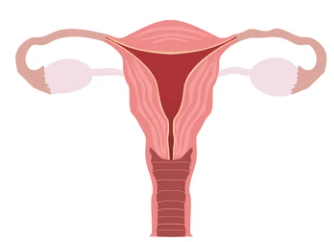 자궁경부암 4기 생존율