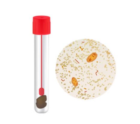 Stool WBC 수치와 임상적 의의