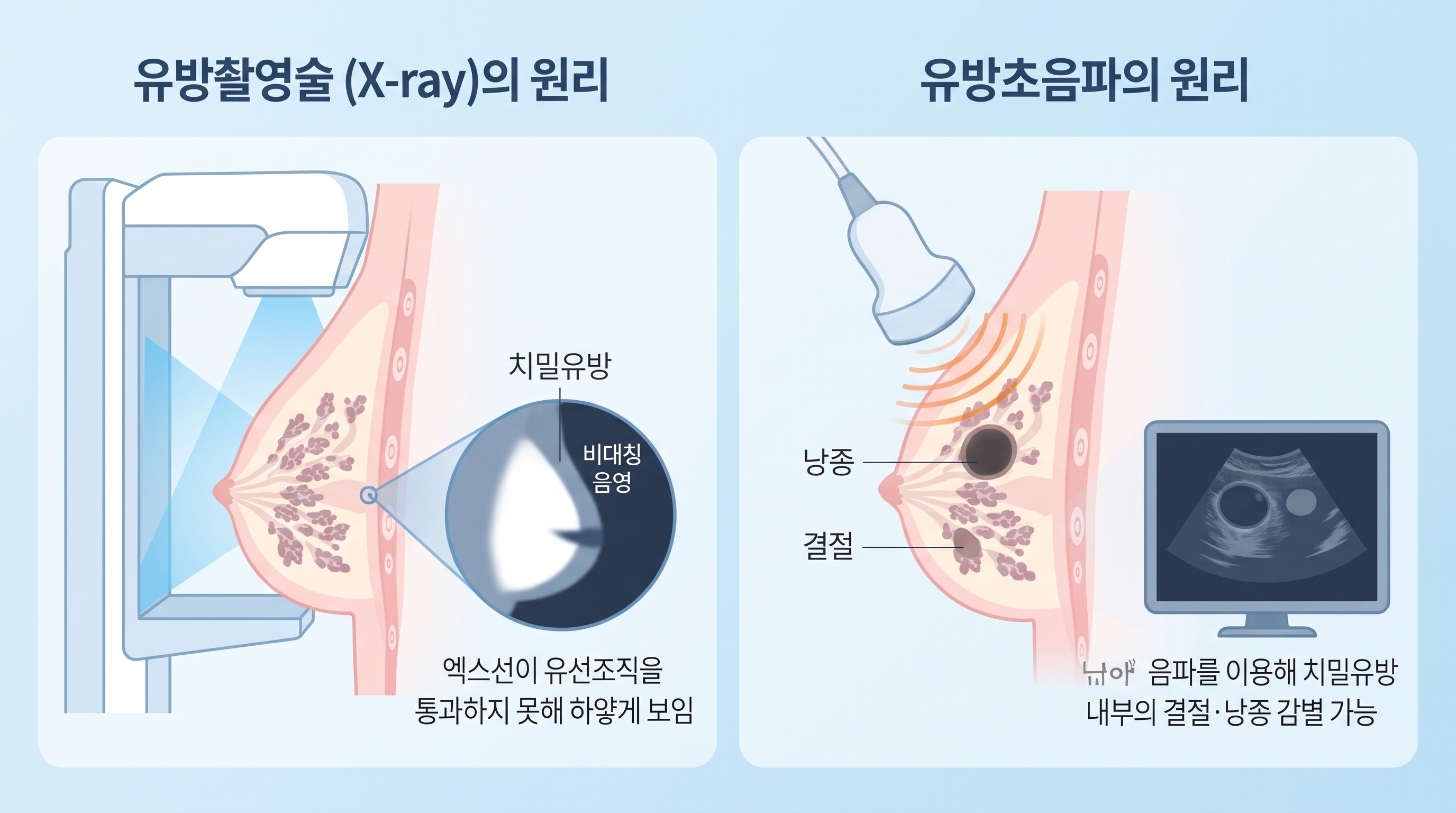 국가건강검진 유방촬영술과 유방초음파의 기본 원리 및 작용 대상을 보여주는 해부학적으로 과장되지 않은 단순 도식 다이어그램