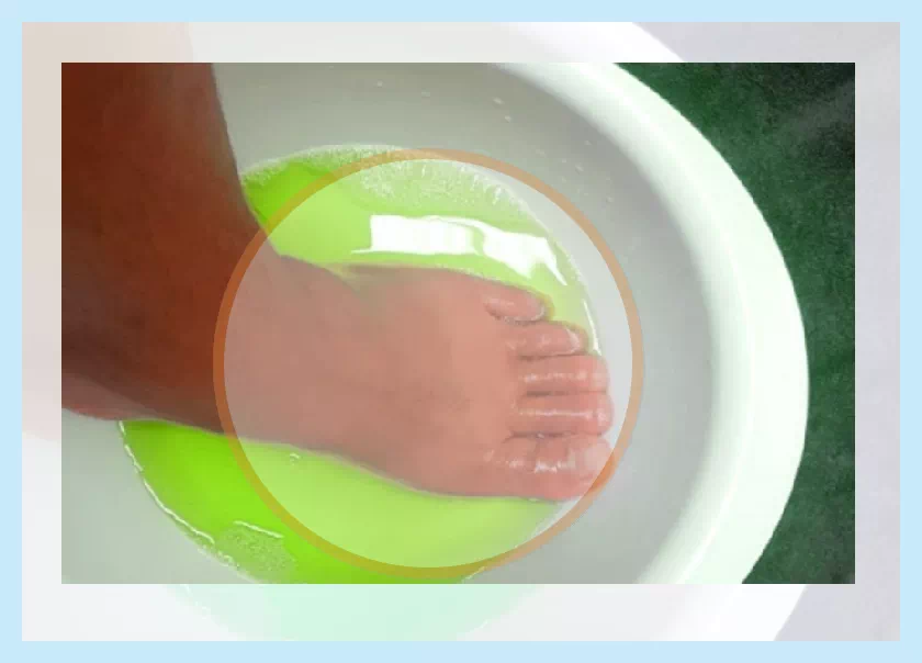 리스테린 무좀 치료