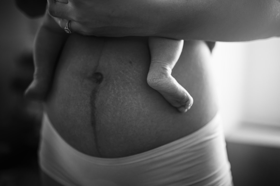 Postpartum.