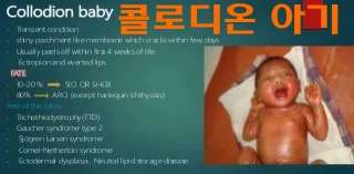 콜로디온 베이비 사진입니다