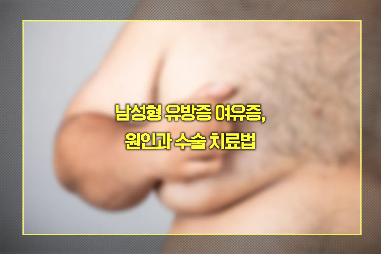 남성형 유방증 여유증 원인 수술