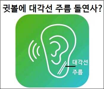 귓볼에 대각선 주름 돌연사