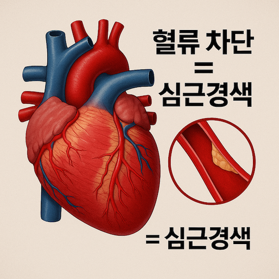 심근경색이 되는 과정의 이해를 돕는 인포그래픽