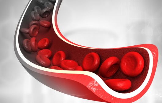 말초동맥 질환 증상