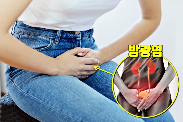 방광염 증상 원인, 여름에 많이 걸리는 병, 건강 팁줌 매일꿀정보