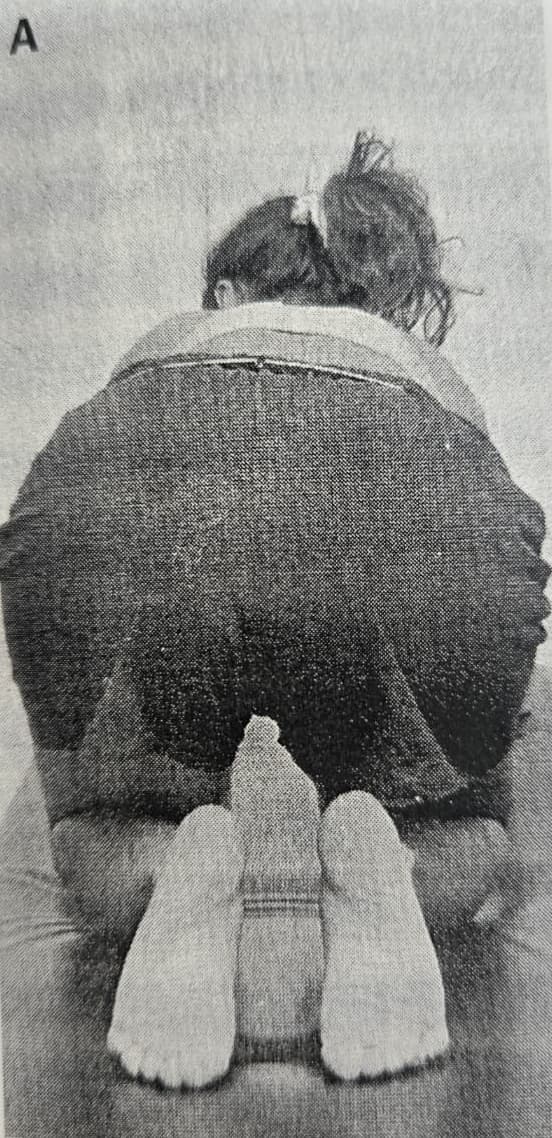 요추 회전신전 증후군을 평가하는 검사 방법, 자세별로 알아보기