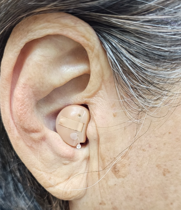 귀속형 보청기 착용사진입니다