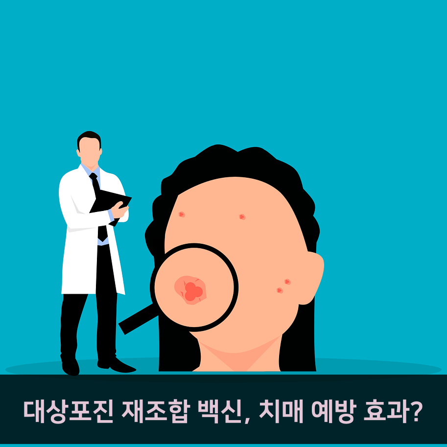 스트레스와 면역력 저하가 부르는 대상포진: 치료와 예방법 이야기