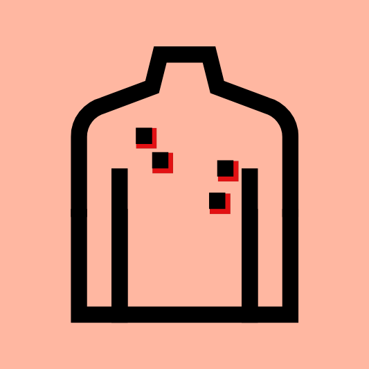땀띠-이미지-예시