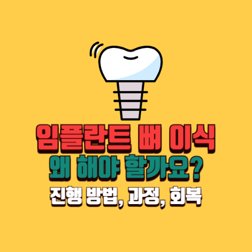 뼈 이식이 필요한 임플란트, 왜 해야 할까요? ❘ 진행 방법, 과정, 회복, 관리