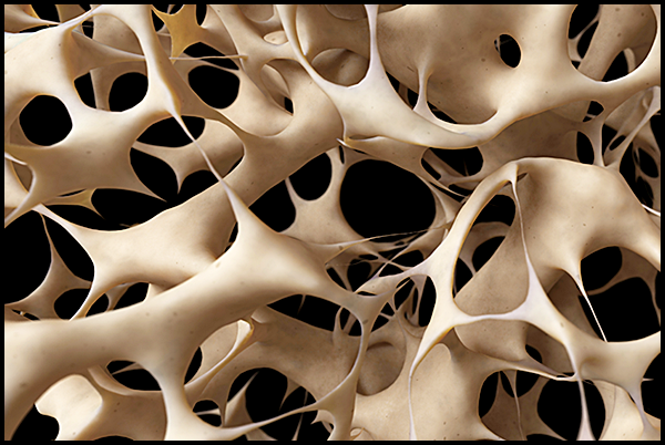 골다공증에 좋은 음식 BEST 8