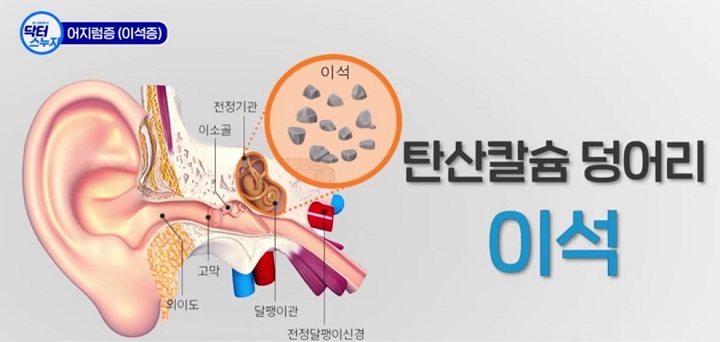 이석의 모습