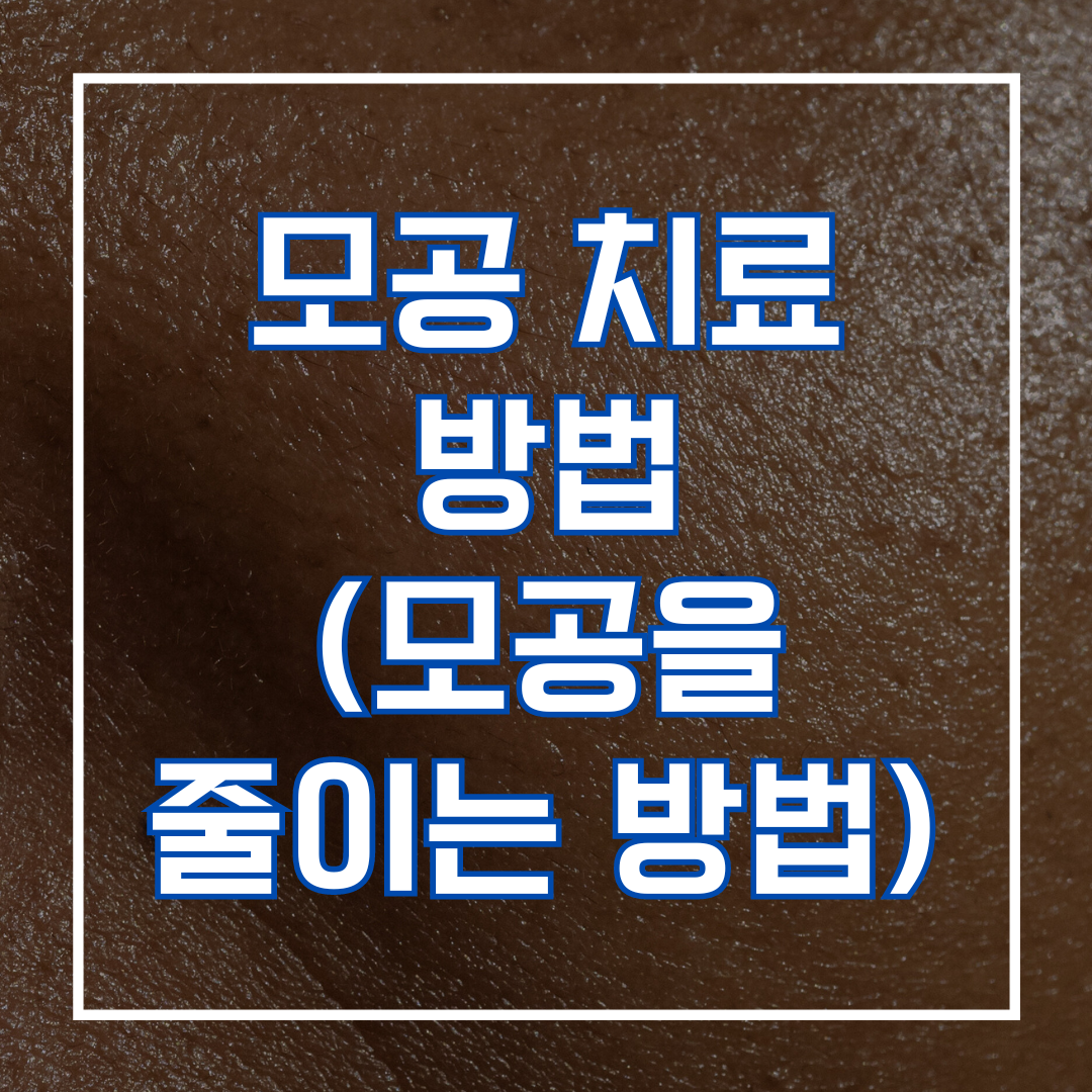 모공 치료 방법 (모공을 줄이는 방법)