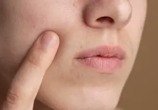 팔자주름