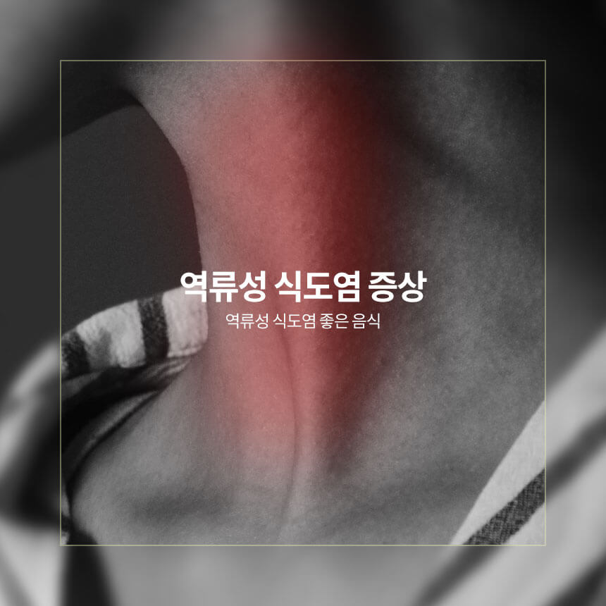 역류성 식도염 증상과 역류성 식도염에 좋은 음식