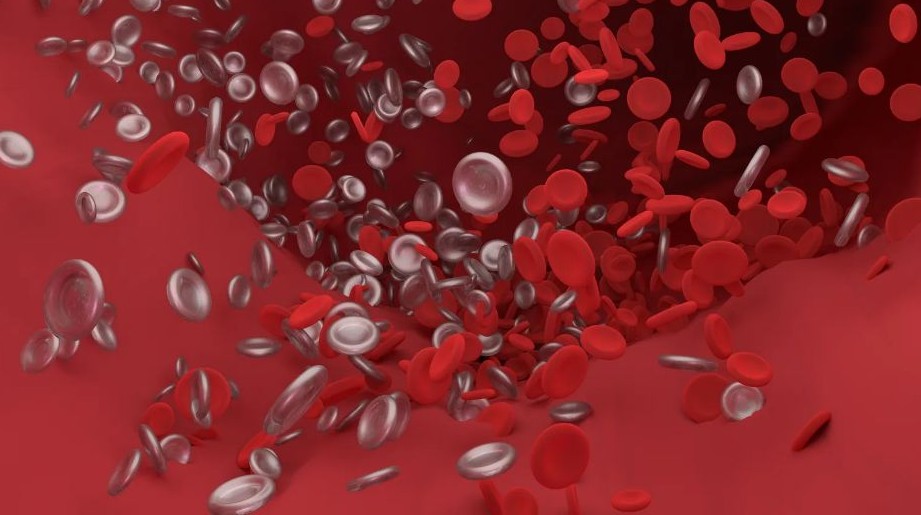 경동맥 협착증 치료