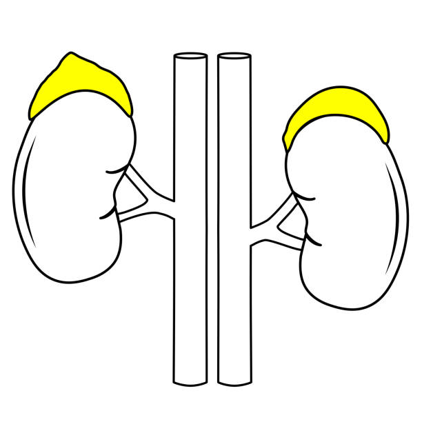 쿠싱증후군 원인