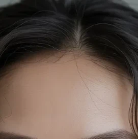 쌍꺼풀 수술 이미지 - 쌍꺼풀 수술을 한 사람