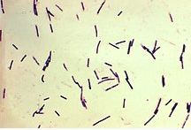 Clostridium perfringens