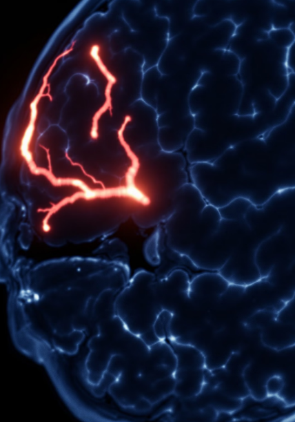 뇌졸증 전조증상과 예방법