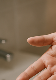 한포진 치료방법