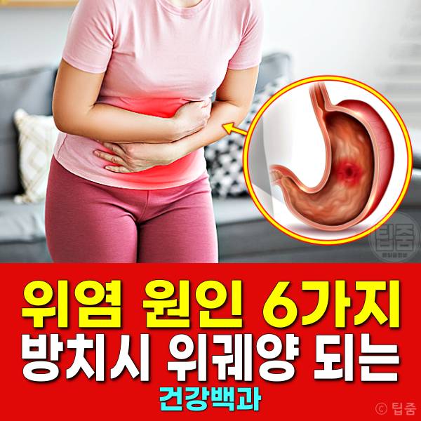 위염 증상 위염원인 위궤양