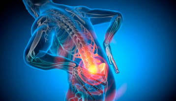 허리 디스크 증상