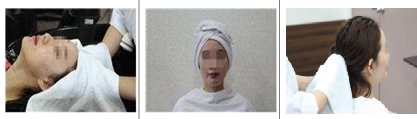 두피