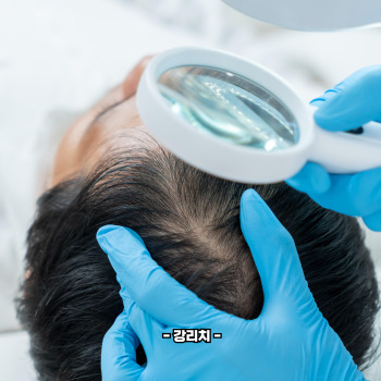 비오틴 효능