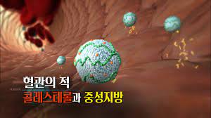 고지혈증
