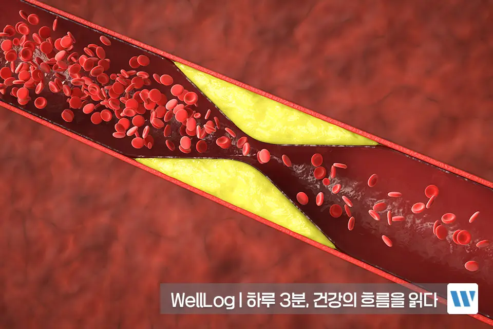 포스파티딜세린 오메가3 효능 비교