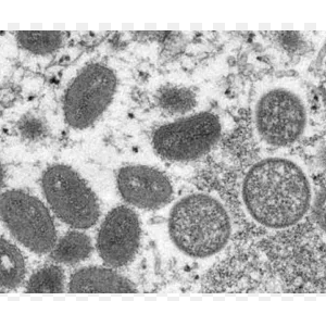 엠폭스 관련주 대장주 테마주 수혜주 TOP5