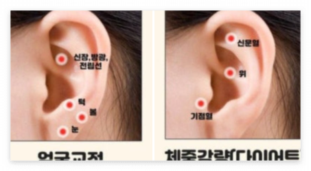 귀이침 다이어트? 혜리 지수 채령이 쓰는 귀침 스티커 붙이는 위치 총정리!