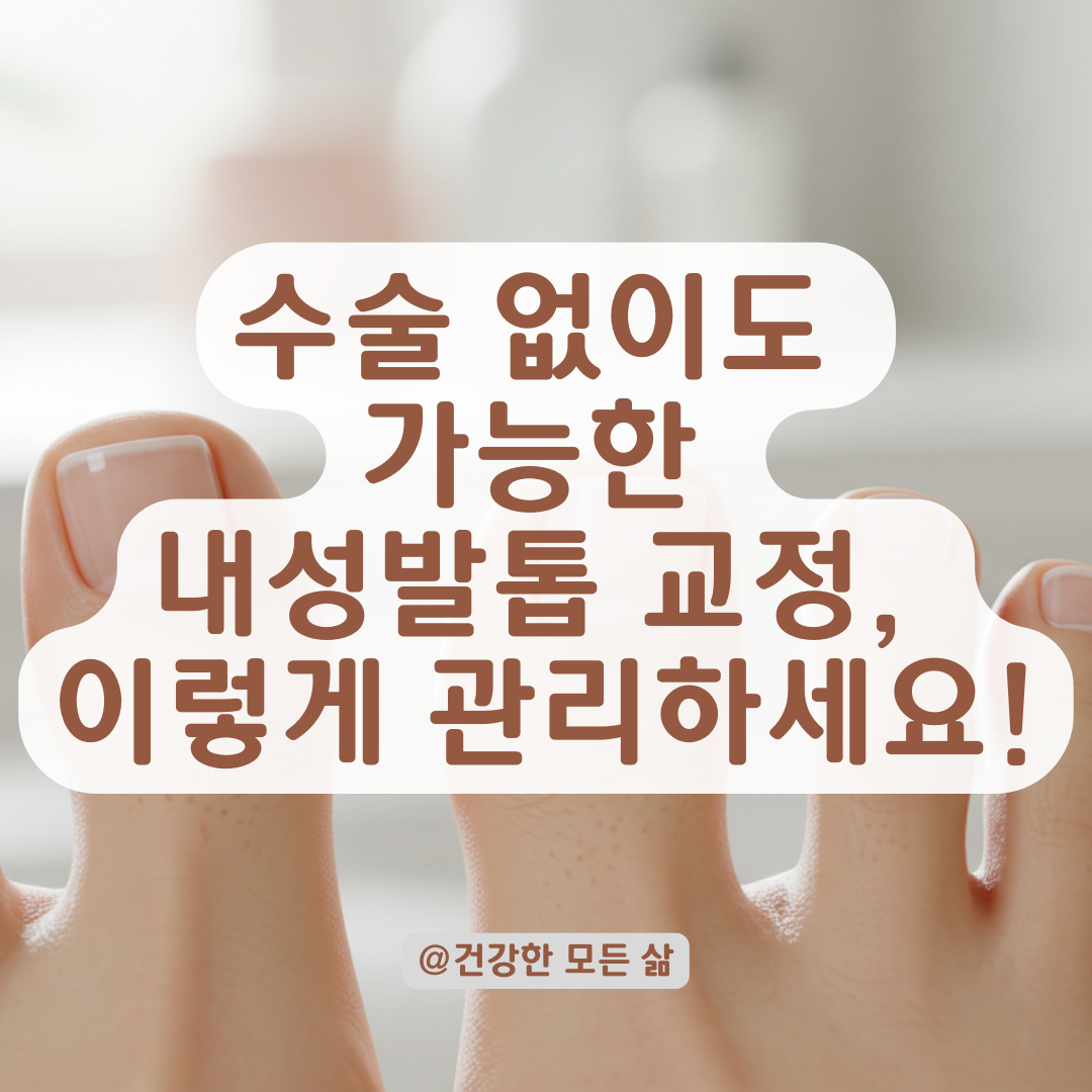 내성발톱, 통증 없이 치료받으려면 꼭 알아야 할 비수술 방법 정리.