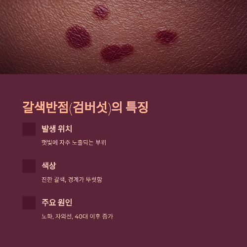 기미와 갈색반점, 똑같은 걸까? 피부 고민 제대로 파헤치기