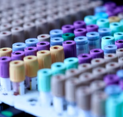 담석증 치료방법 진단기준 합병증