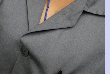 대상포진 치료기간