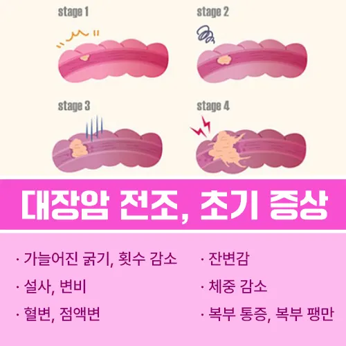 대장암 초기증상
