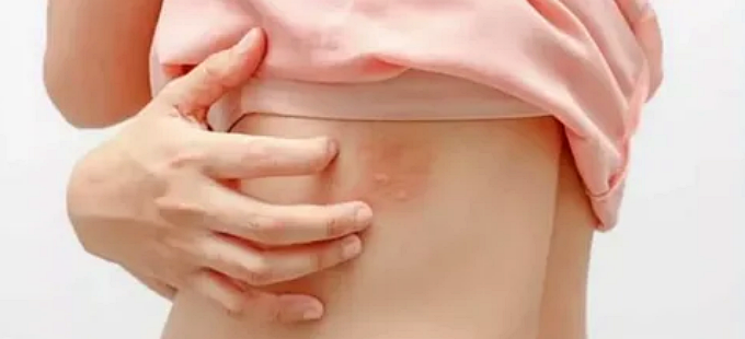 대상포진 예방접종 부작용 및 가격 : 접종 1회면 되나요, 유효기간